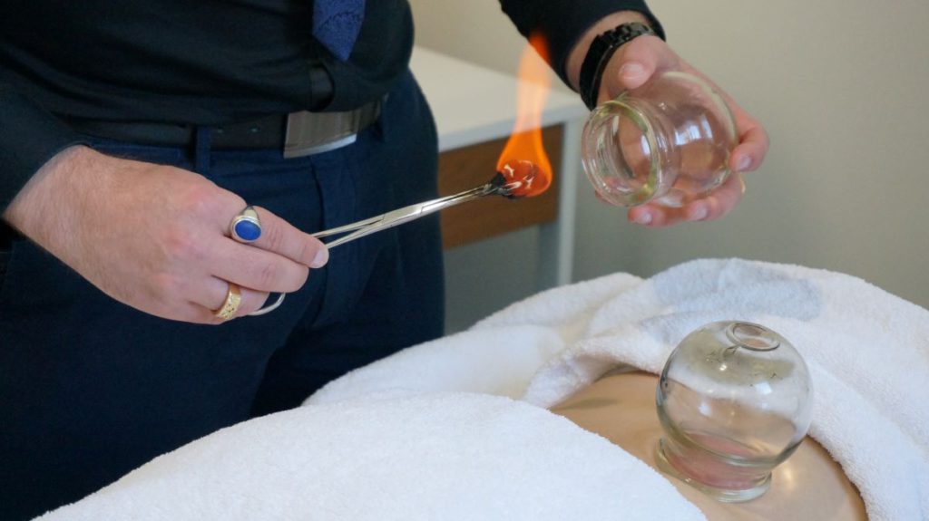 Cupping Therapy in Melbourne: Uncover Its Healing Benefits