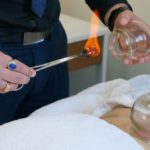 Cupping Therapy in Melbourne: Uncover Its Healing Benefits