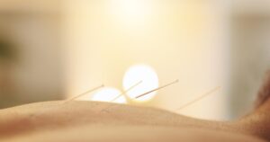 Acupuncture Benefits for Natural Recovery and Healing